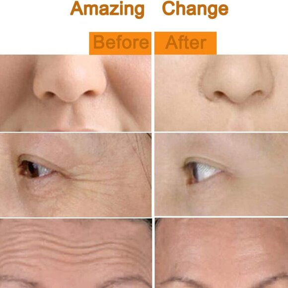 2 in 1 Face Massager Golden Facial Electric 3D Roller and T Shape Arm Eye Nose M - Picture 6 of 6